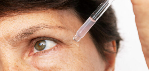 Jak zlikwidować zmarszczki w okolicach oczu?